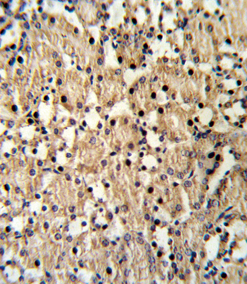 Formalin-fixed and paraffin-embedded mouse kidney reacted with PAX8 Antibody , which was peroxidase-conjugated to the secondary antibody, followed by DAB staining. This data demonstrates the use of this antibody for immunohistochemistry; clinical relevance has not been evaluated.
