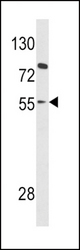 Western blot of PAX8 Antibody in HL-60 cell line lysates (35 ug/lane). PAX8 (arrow) was detected using the purified antibody.