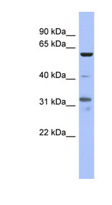 PAX8 antibody LS-B5611 Western blot of NCI-H226 cell lysate.