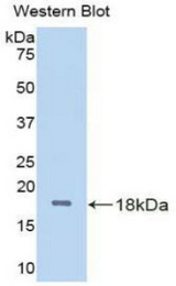 Western blot of recombinant O-GlcNAcase / MGEA5.