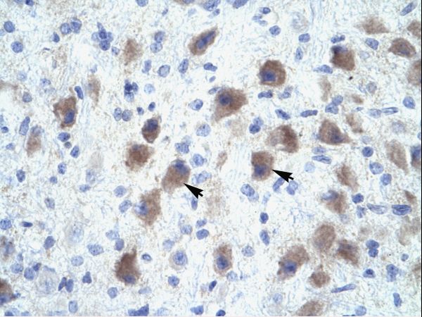 PAX9 antibody LS-C29838 was used in IHC to stain formalin-fixed, paraffin-embedded human brain.
