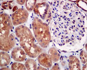 IHC of paraffin-embedded human kidney tissue using anti-MGEA5 antibody.