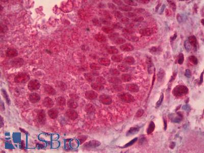 Anti-PAX9 antibody IHC of human uterus, endometrium. Immunohistochemistry of formalin-fixed, paraffin-embedded tissue after heat-induced antigen retrieval. Antibody LS-B6405 concentration 5 ug/ml.