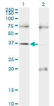 Western blot of PAX9 expression in transfected 293T cell line by PAX9 monoclonal antibody, clone 3B8.