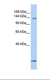 MCF7 cell lysate. Antibody concentration: 1.0 ug/ml. Gel concentration: 6-18%.