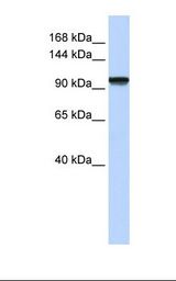 Fetal muscle lysate. Antibody concentration: 1.0 ug/ml. Gel concentration: 6-18%.