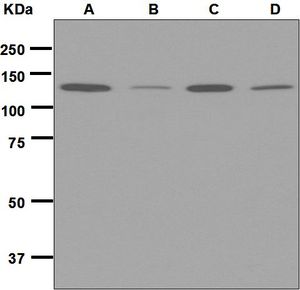 Western blot analysis on (A) HeLa, (B) BxPC-3, (C) JAR, and (D) fetal brain lysates using anti-MGEA5 antibody.