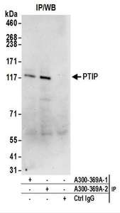 Detection of Human PTIP by Western Blot of Immunoprecipitates. Samples: Whole cell lysate (1 mg for IP; 20% of IP loaded) from 293T cells. Antibodies: Affinity purified rabbit anti-PTIP antibody used for IP at 6 ug/mg lysate. PTIP was also immunoprecipitated by a previous lot of this antibody. For blotting immunoprecipitated PTIP, was used at 1 ug/ml. Detection: Chemiluminescence with an exposure time of 30 seconds.