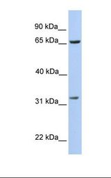 721_B cell lysate. Antibody concentration: 1.0 ug/ml. Gel concentration: 12%.