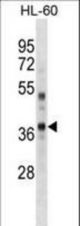 PBK/TOPK Antibody (Mouse C-term) western blot of HL-60 cell line lysates (35 ug/lane). The PBK/TOPK antibody detected the PBK/TOPK protein (arrow).