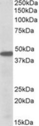 PBX1 antibody (0.5 ug/ml) staining of K562 lysate (35 ug protein/ml in RIPA buffer). Primary incubation was 1 hour. Detected by chemiluminescence.