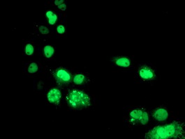 Anti-PBX1 mouse monoclonal antibody immunofluorescent staining of COS7 cells transiently transfected by pCMV6-ENTRY PBX1.