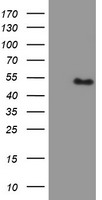HEK293T cells were transfected with the pCMV6-ENTRY control (Left lane) or pCMV6-ENTRY PBX1 (Right lane) cDNA for 48 hrs and lysed. Equivalent amounts of cell lysates (5 ug per lane) were separated by SDS-PAGE and immunoblotted with anti-PBX1.