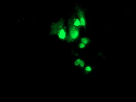 Anti-PBX1 mouse monoclonal antibody immunofluorescent staining of COS7 cells transiently transfected by pCMV6-ENTRY PBX1.