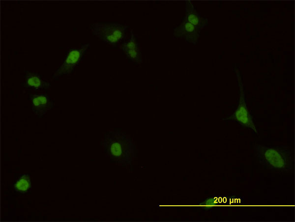 Immunofluorescence of monoclonal antibody to PBX1 on HeLa cell. [antibody concentration 10 ug/ml]