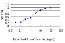 Detection limit for recombinant GST tagged PBX1 is approximately 0.03 ng/ml as a capture antibody.