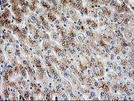 IHC of paraffin-embedded Human liver tissue using anti-PBX1 mouse monoclonal antibody.
