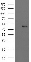 HEK293T cells were transfected with the pCMV6-ENTRY control (Left lane) or pCMV6-ENTRY PBX1 (Right lane) cDNA for 48 hrs and lysed. Equivalent amounts of cell lysates (5 ug per lane) were separated by SDS-PAGE and immunoblotted with anti-PBX1.