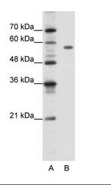 A: Marker, B: Jurkat Cell Lysate