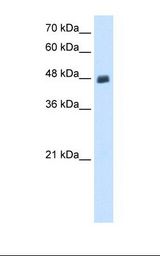 Transfected 293T cell lysate. Antibody concentration: 0.5 ug/ml. Gel concentration: 12%.