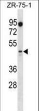PBX2 Antibody western blot of ZR-75-1 cell line lysates (35 ug/lane). The PBX2 antibody detected the PBX2 protein (arrow).
