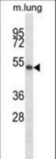 PBX2 Antibody western blot of mouse lung tissue lysates (35 ug/lane). The PBX2 antibody detected the PBX2 protein (arrow).