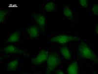Immunostaining analysis in HeLa cells. HeLa cells were fixed with 4% paraformaldehyde and permeabilized with 0.1% Triton X-100 in PBS. The cells were immunostained with anti-PBX2 mAb.