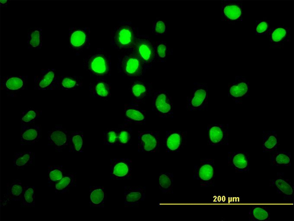 Immunofluorescence of monoclonal antibody to PBX2 on HeLa cell. [antibody concentration 10 ug/ml]