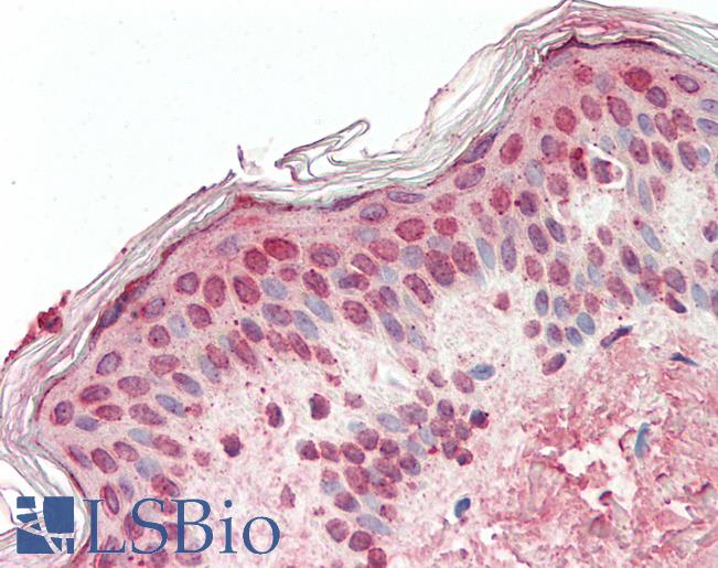 Human, Skin: Formalin-Fixed Paraffin-Embedded (FFPE)