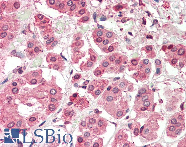 Human, Adrenal: Formalin-Fixed Paraffin-Embedded (FFPE)