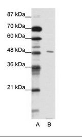 A: Marker, B: HepG2 Cell Lysate