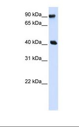 Transfected 293T cell lysate. Antibody concentration: 1.0 ug/ml. Gel concentration: 12%.