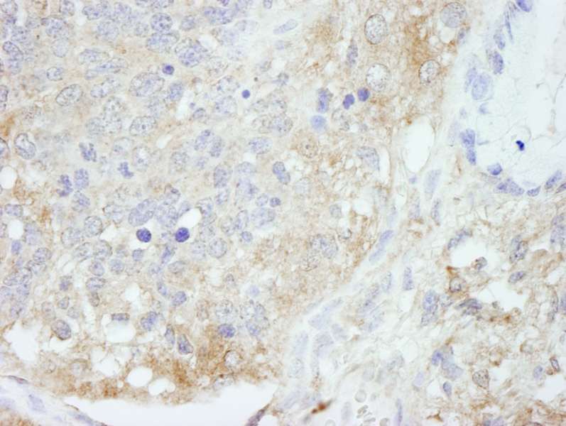 Detection of Mouse HPIP by Immunohistochemistry. Sample: FFPE section of mouse teratoma. Antibody: Affinity purified rabbit anti-HPIP used at a dilution of 1:100.
