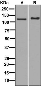 Western blot analysis on (A) mouse brain and (B) rat brain lysates using anti-Pyruvate Carboxylase antibody.