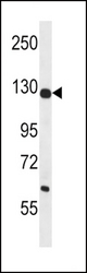 PC Antibody western blot of mouse liver tissue lysates (35 ug/lane). The PC antibody detected the PC protein (arrow).