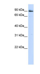 PCSK5 / PC5 antibody LS-C110797 Western blot of 293T cell lysate.