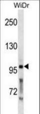 PCSK5 Antibody western blot of WiDr cell line lysates (35 ug/lane). The PCSK5 antibody detected the PCSK5 protein (arrow).