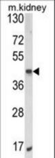 Western blot of ALKBH3 Antibody in mouse kidney tissue lysates (35 ug/lane). ALKBH3 (arrow) was detected using the purified antibody.