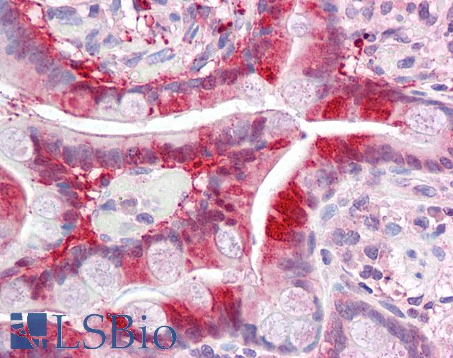 Anti-ALKBH3 antibody IHC of human small intestine. Immunohistochemistry of formalin-fixed, paraffin-embedded tissue after heat-induced antigen retrieval. Antibody LS-B5865 concentration 5 ug/ml.