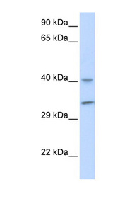 ALKBH3 antibody LS-B5865 Western blot of Fetal Muscle lysate.