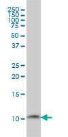 PCBD1 monoclonal antibody (M01), clone 1G11-H5 Western Blot analysis of PCBD1 expression in C32.