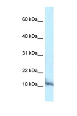 PCBD1 / PCD antibody LS-C145430 Western blot of Mouse Brain lysate. Antibody concentration 1 ug/ml.