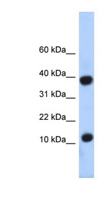 PCBD1 / PCD antibody LS-C101393 Western blot of Fetal Liver lysate.