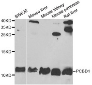Western blot analysis of extracts of various cell lines, using PCBD1 antibody.