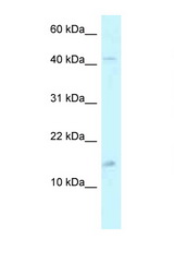 PCBD2 antibody LS-C145553 Western blot of 1 Cell lysate. Antibody concentration 1 ug/ml.