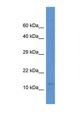 PCBD2 antibody LS-C135806 Western blot of Small Intestine lysate. Antibody concentration 1 ug/ml.