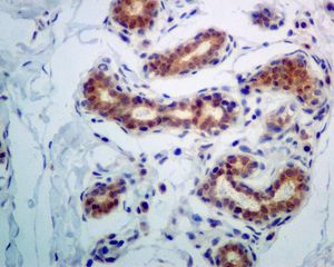 IHC of paraffin-embedded human breast tissue using anti-PCBD2 antibody.