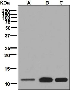 Western blot analysis on (A) fetal liver, (B) Caco-2, and (C) BxPC-3 lysates using anti-PCBD2 antibody.