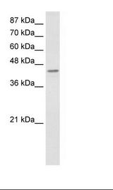Jurkat Cell Lysate
