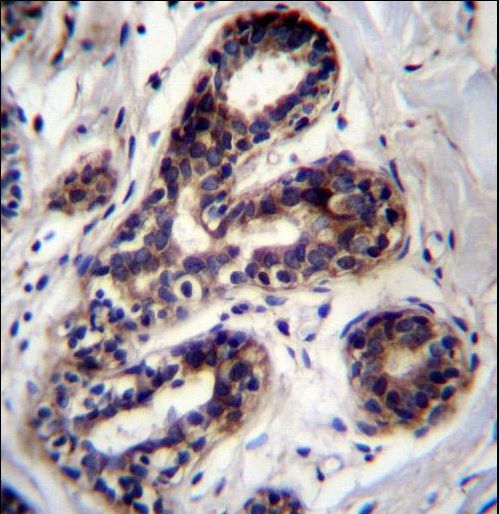PCCA Antibody immunohistochemistry of formalin-fixed and paraffin-embedded human breast tissue followed by peroxidase-conjugated secondary antibody and DAB staining.